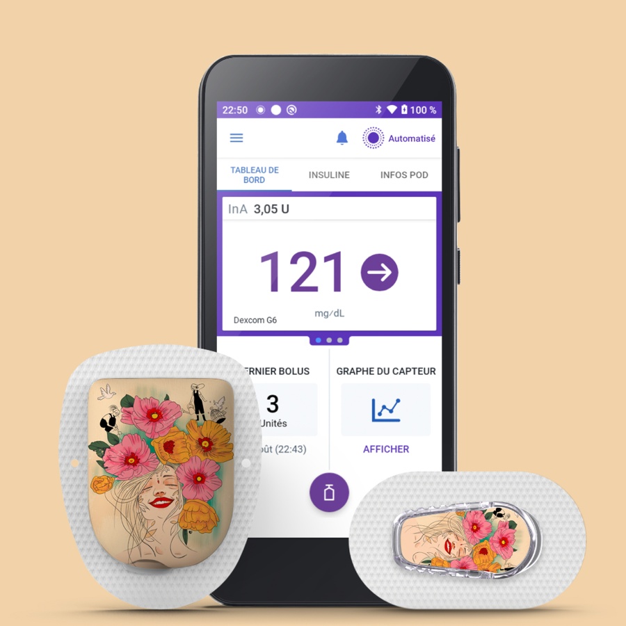 Dispositifs pour le diabete- L'utopiste de Neuvieme Planète